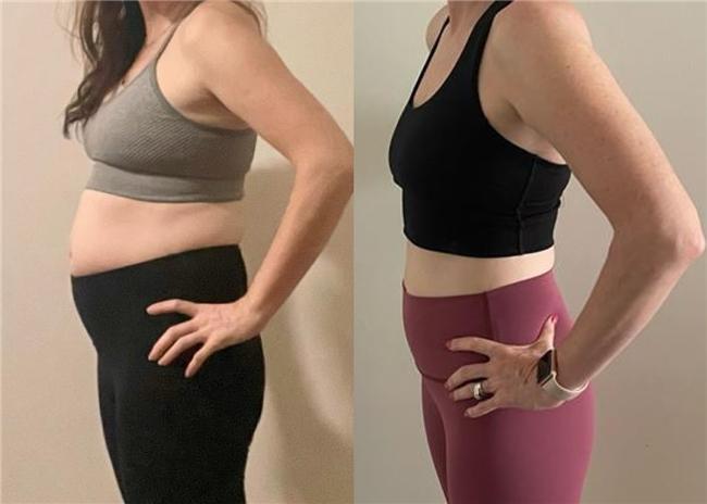 助力燃脂的实用品牌减肥哪个牌子好开元棋牌轻松减肥产品TOP榜：(图9)